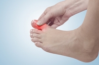 Osteoarthritis May Be Damaging Your Big Toe Joint