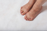 Understanding Hammertoes, Claw Toes, and Mallet Toes